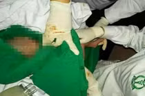 Bác sĩ dùng đèn smartphone đỡ đẻ giữa đêm