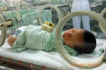 Sức sống mãnh liệt của bé và mẹ ngừng tim khi chuyển dạ