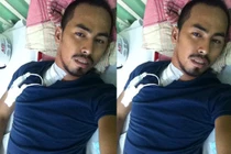 Duy Nhân chảy máu mắt, co giật sau ghép tủy chữa ung thư