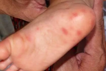 Nhận biết dấu hiệu bé bị bạo hành ở trường học