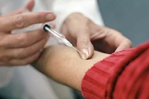 Bệnh lạ ở Quảng Nam làm chết người là bệnh bạch hầu