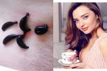 Bí quyết làm đẹp bằng... đỉa của thiên thần Miranda Kerr