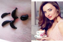 Bí quyết làm đẹp bằng... đỉa của thiên thần Miranda Kerr