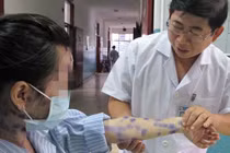 La liệt người lớn nhập viện vì dịch thủy đậu sau Tết