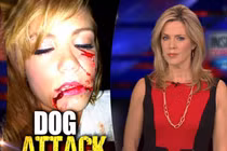 Những vụ động vật tấn công người thê thảm nhất 