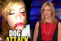 Những vụ động vật tấn công người thê thảm nhất 