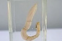 Những loài giun, sâu "quái, độc" nhất thế giới