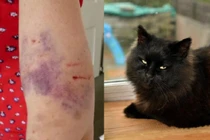 Hãi hùng mèo “ác quỷ” tấn công người