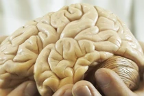 Những bộ phận người máy trên cơ thể người