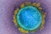 Phát hiện biến thể COVID-19 mới với đột biến nguy hiểm