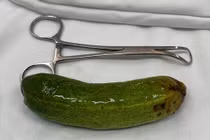 “Sửng sốt” với quả dưa leo trong hậu môn nam thanh niên thích cảm giác lạ