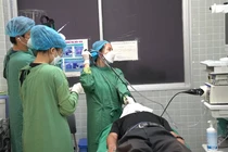 Sốc với dị vật xương ống heo nằm trong phổi suốt 20 năm