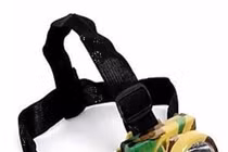 Đèn pin bắn ngược, nhãn cầu mắt bé gái 5 tuổi bị đẩy ra ngoài 