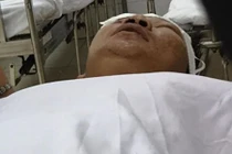 Cãi với bảo vệ, hai anh em bị người lạ chém trọng thương