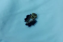 Nam sinh 19 tuổi ở TPHCM suýt tiêu “của quý” vì... khóa quần