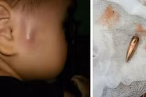 Phó Thủ tướng chỉ đạo nóng vụ đạn lạc ở Vĩnh Phúc