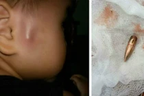 Phó Thủ tướng chỉ đạo nóng vụ đạn lạc ở Vĩnh Phúc