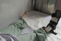 Truy tìm tài xế ô tô cán nát bàn chân nữ sinh viên