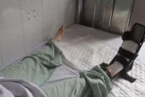 Truy tìm tài xế ô tô cán nát bàn chân nữ sinh viên