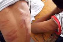 Nghi án học sinh lớp 8 ở Hà Tĩnh bị bố ruột đánh đập dã man