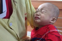 Bé trai 18 tháng tuổi nguy cơ mù cả hai mắt