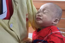 Bé trai 18 tháng tuổi nguy cơ mù cả hai mắt