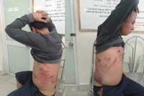 Hà Nội: Nghi vấn phản đối thu phí BOT, tài xế bị đánh gãy xương sườn?