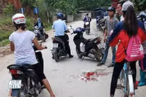 Ghê sợ nguyên nhân khiến chồng cầm dao đâm vào mặt vợ