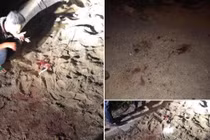 Kinh hoàng bé trai 7 tuổi bị đàn chó cắn xe, nguy kịch