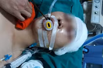 Hà Nội: Nam sinh bị đánh trọng thương ngay cửa nhà