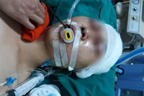 Hà Nội: Nam sinh bị đánh trọng thương ngay cửa nhà