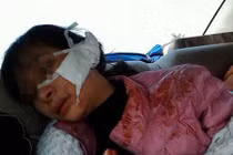 Video: Toàn cảnh hiện trường nữ sinh lớp 11 bị rạch mặt dã man