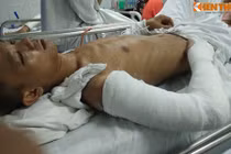 Đang ngồi uống nước, bị hàng chục côn đồ truy sát