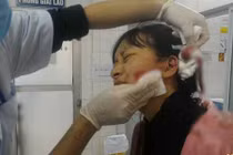 Khởi tố vụ án nữ sinh bị rạch mặt dã man ở Thanh Hóa