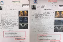 Sở Y tế HN nói gì về chuyện lùm xùm ở Bệnh viện đa khoa 16A Hà Đông?