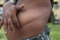 Đường dây bán thận 300 triệu đồng ở Hà Nội hoạt động thế nào?