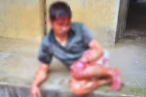 Bắc Giang: Sang vườn hàng xóm bẻ cây cối bị chém 7 nhát