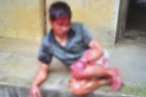 Bắc Giang: Sang vườn hàng xóm bẻ cây cối bị chém 7 nhát