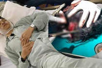 Kinh hoàng tài xế ô tô Mazda 3 bị chém toác đầu sau va chạm 