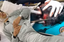 Kinh hoàng tài xế ô tô Mazda 3 bị chém toác đầu sau va chạm 