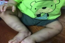 Sức khỏe bé trai 1 tuổi nguy kịch, hình phạt nào cho kẻ bạo hành?