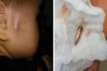 Đạn rơi từ trên cao trúng nhiều người, Công an Vĩnh Phúc nói gì?