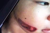 Tình tiết bất ngờ vụ nghi bé 7 tuổi bị cha ruột và mẹ kế bạo hành