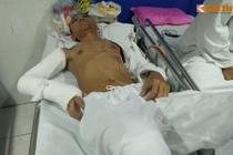 Nạn nhân bị truy sát: Nằm viện vẫn bị gọi điện hăm dọa