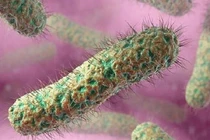 Hai trẻ là anh em ruột nghi tử vong do vi khuẩn ăn mòn cơ thể Whitmore