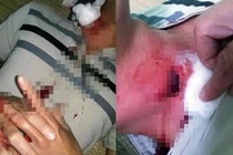 Điều tra nghi vấn “đạn lạc” bay trúng cổ họng người dân ở Hòa Bình