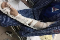 HN: Đánh người vì tranh giành “địa bàn” dán giấy thông tắc bể phốt