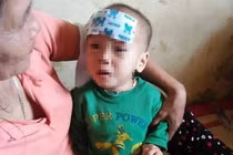 Nhói lòng bé gái 15 tháng tuổi bị bỏ rơi ở bụi tre