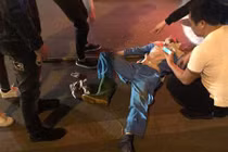 Hà Nội: Công nhân môi trường bị xe máy đâm vỡ hộp sọ