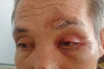 Đánh người nhập viện vì nợ 190 nghìn đồng ở Hà Nội